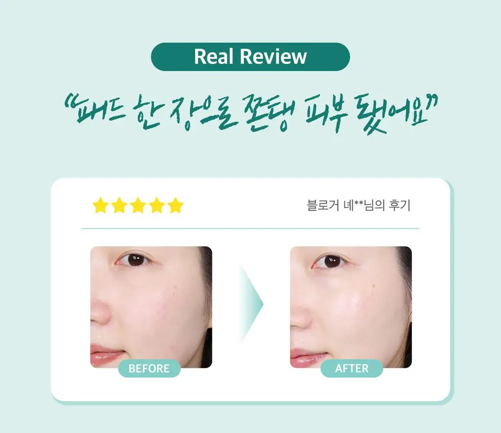 [수분탄력/모공탄력] 테라비코스 히알루론산 3000 앰플 패드 70매 상세페이지 27